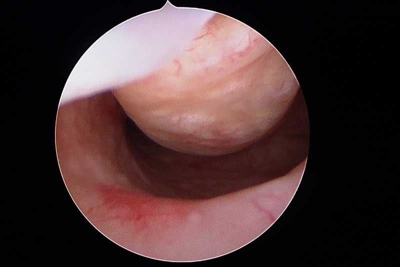 endo_service_1-Main-photo_-gyn-endo_benign-disease endo_service_1-Main-photo_-gyn-endo_benign-disease